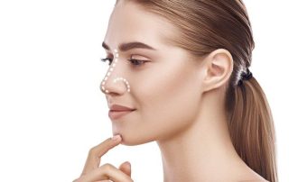 rinoplastia