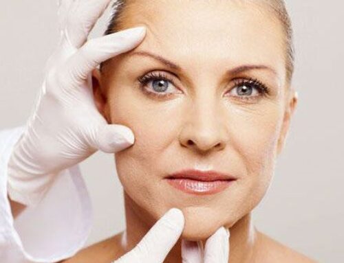 Deep Plane Facelift: una evolución del lifting facial para rejuvenecer el rostro de forma natural