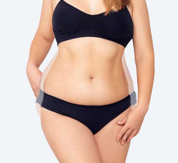 abdominoplastia