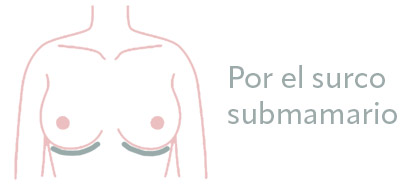 aumento mamario surco submamario