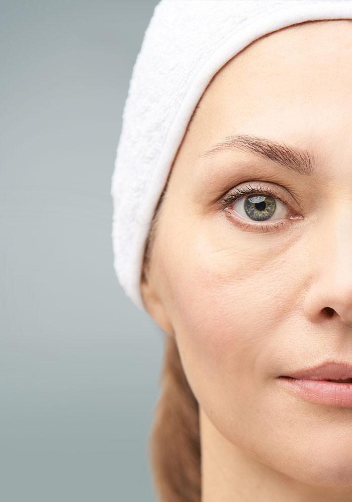 blefaroplastia Barcelona