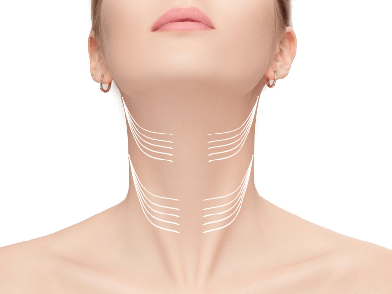 lifting cuello y papada