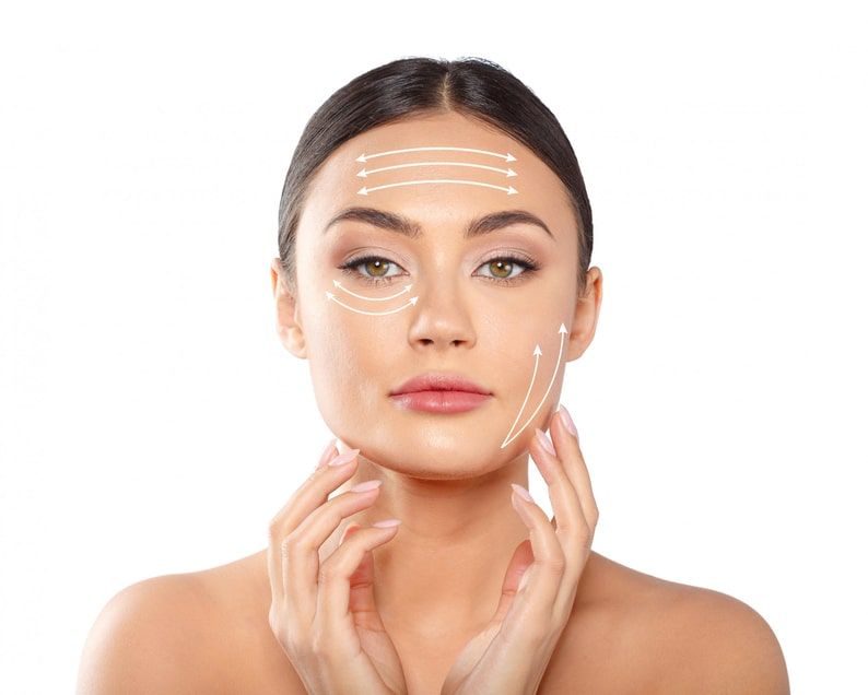 lifting_facial_minimamente_invasivo