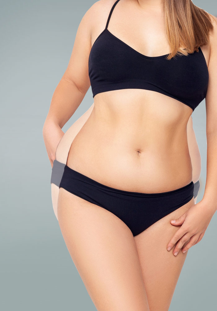 abdominoplastia en Barcelona