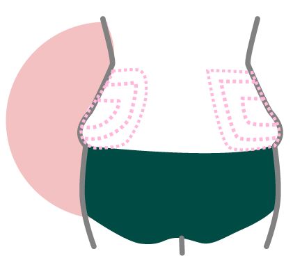lipo espalda y flancos