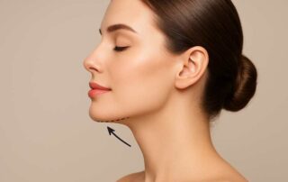 mentoplastia sin implantes