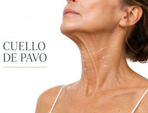 Bandas platismales y cuello de pavo: por qué aparecen y cómo rejuvenecer el cuello